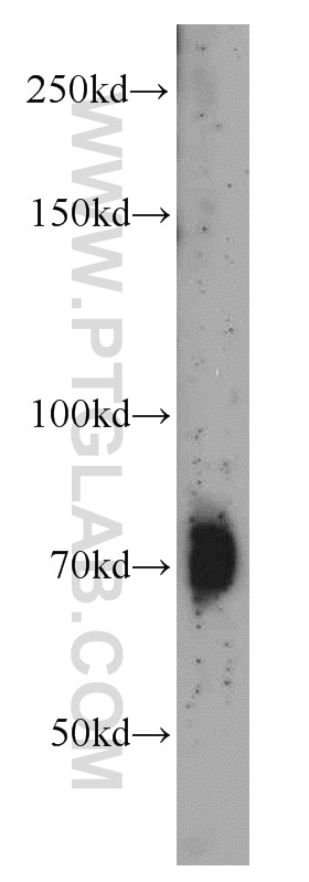 Western Blot (WB) analysis of PC-3 cells using SYNPO2L Polyclonal antibody (21480-1-AP)