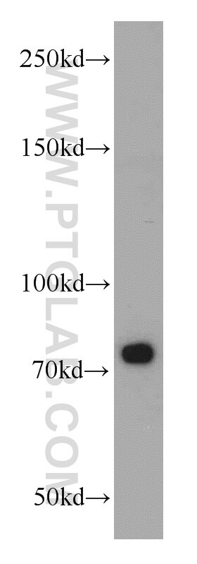 Western Blot (WB) analysis of mouse testis tissue using SYNPO2L Polyclonal antibody (21480-1-AP)