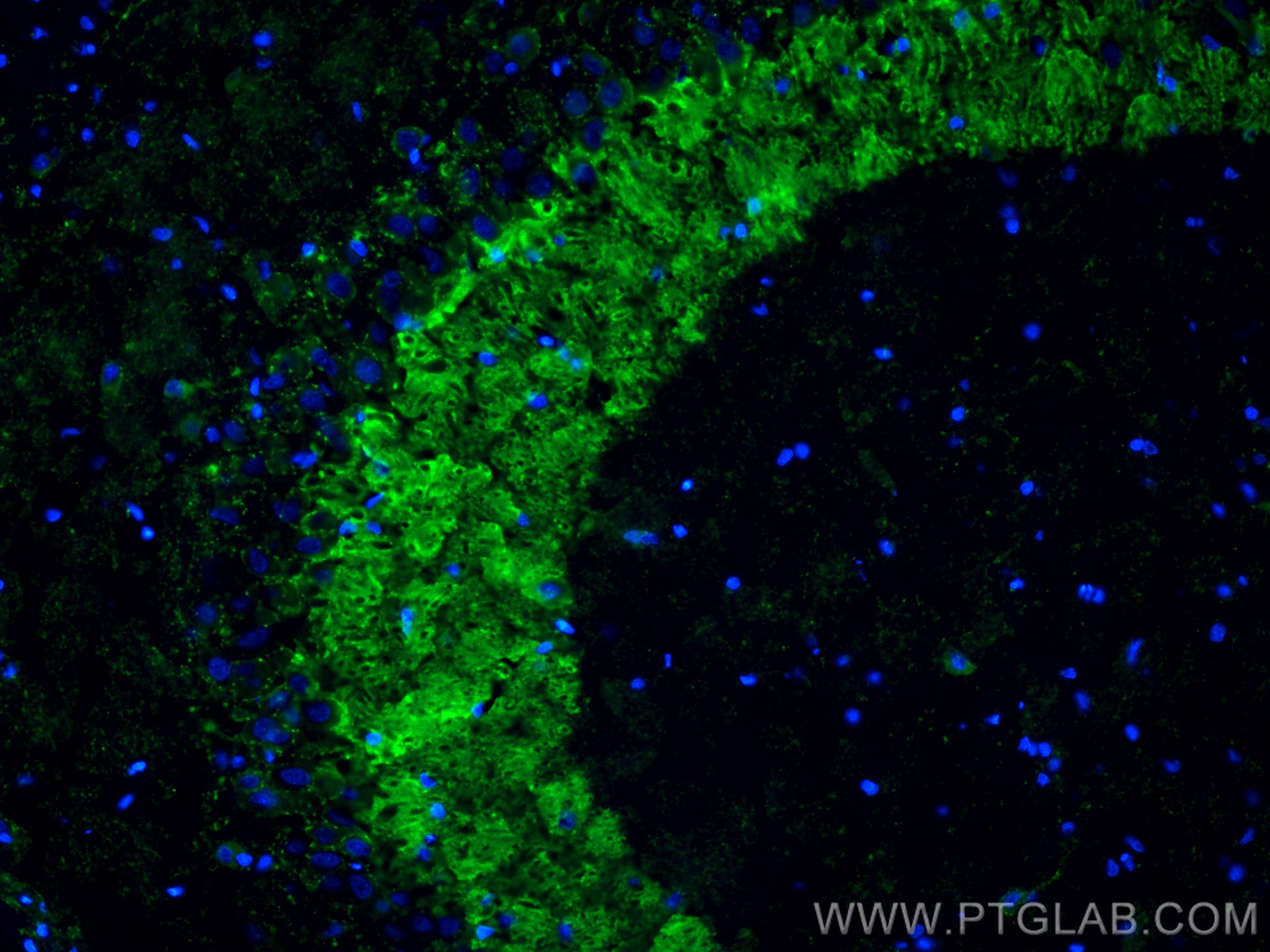 Immunofluorescence (IF) / fluorescent staining of rat brain tissue using Synaptoporin Polyclonal antibody (14143-1-AP)