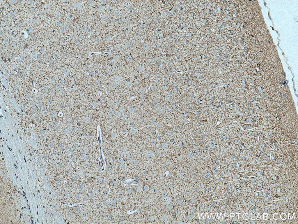 Immunohistochemistry (IHC) staining of mouse brain tissue using Synaptoporin Polyclonal antibody (14143-1-AP)