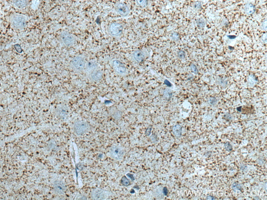 Immunohistochemistry (IHC) staining of mouse brain tissue using Synaptoporin Polyclonal antibody (14143-1-AP)
