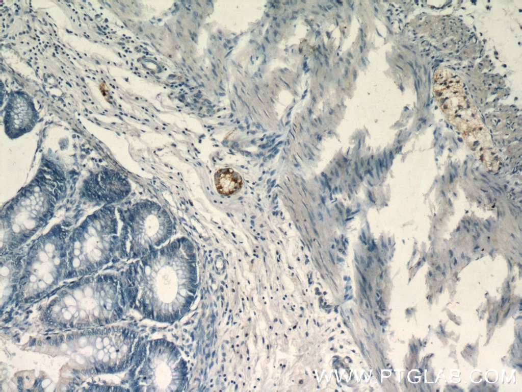 Immunohistochemistry (IHC) staining of human colon tissue using Synaptoporin Polyclonal antibody (14143-1-AP)