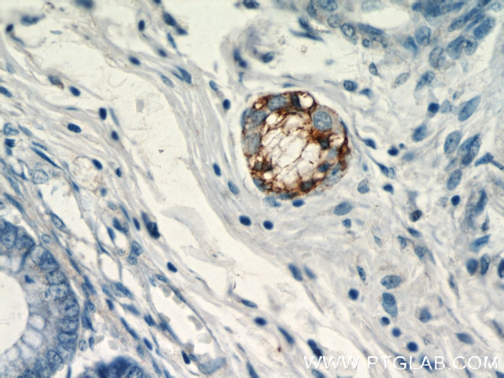 Immunohistochemistry (IHC) staining of human colon tissue using Synaptoporin Polyclonal antibody (14143-1-AP)