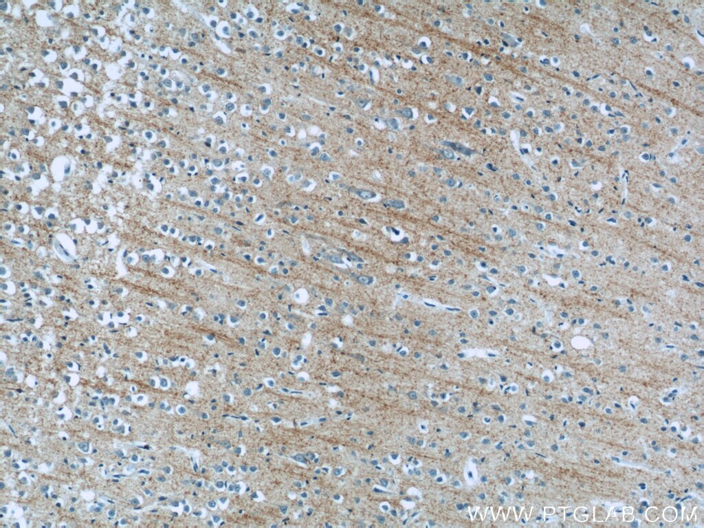 Immunohistochemistry (IHC) staining of human brain tissue using Synaptoporin Polyclonal antibody (14143-1-AP)