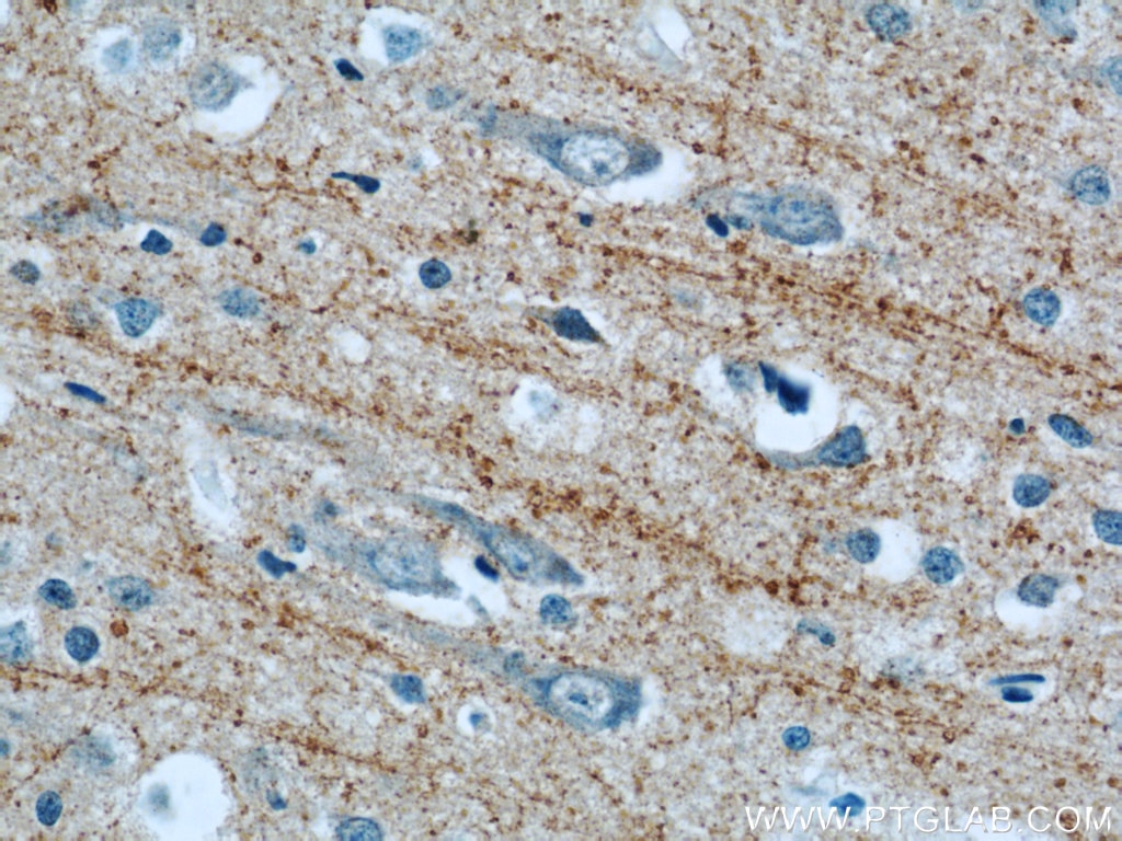 Immunohistochemistry (IHC) staining of human brain tissue using Synaptoporin Polyclonal antibody (14143-1-AP)
