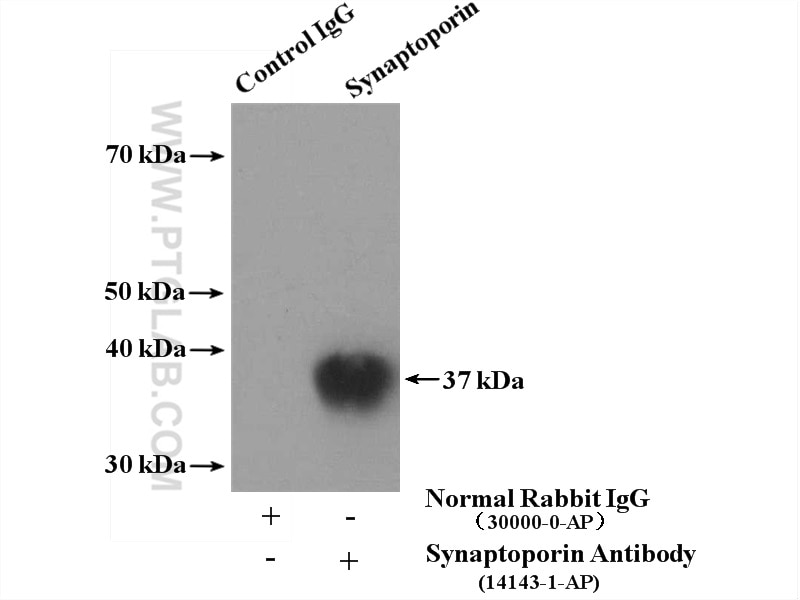 Immunoprecipitation (IP) experiment of mouse brain tissue using Synaptoporin Polyclonal antibody (14143-1-AP)