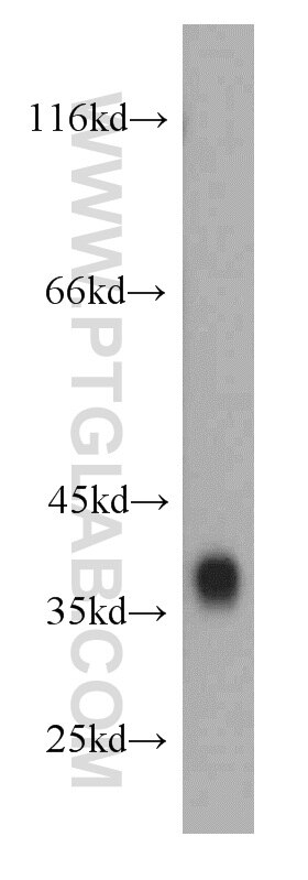 Western Blot (WB) analysis of human brain tissue using Synaptoporin Polyclonal antibody (14143-1-AP)