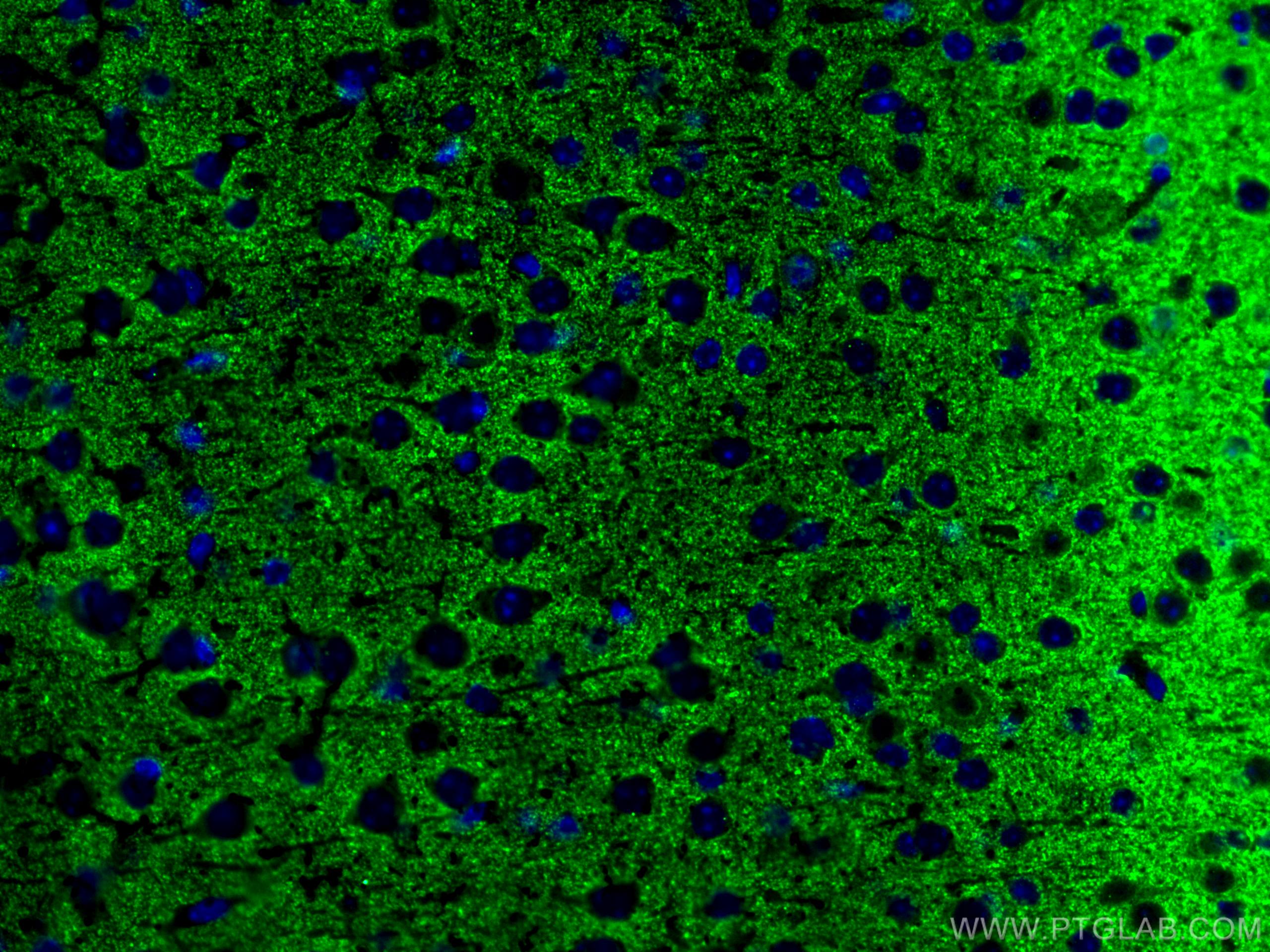 Immunofluorescence (IF) / fluorescent staining of mouse brain tissue using Synaptophysin Polyclonal antibody (17785-1-AP)