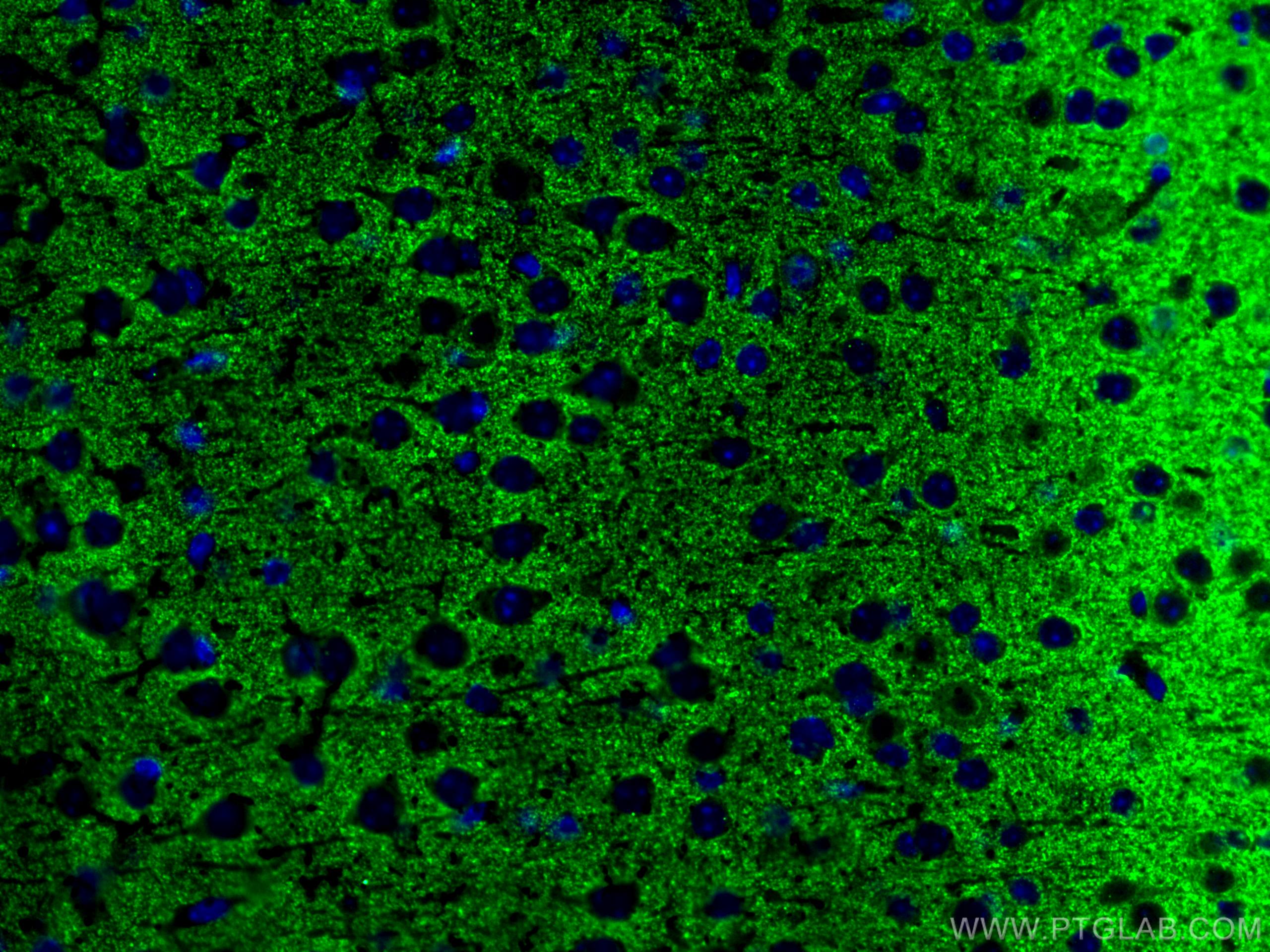 IF Staining of mouse brain using 17785-1-AP