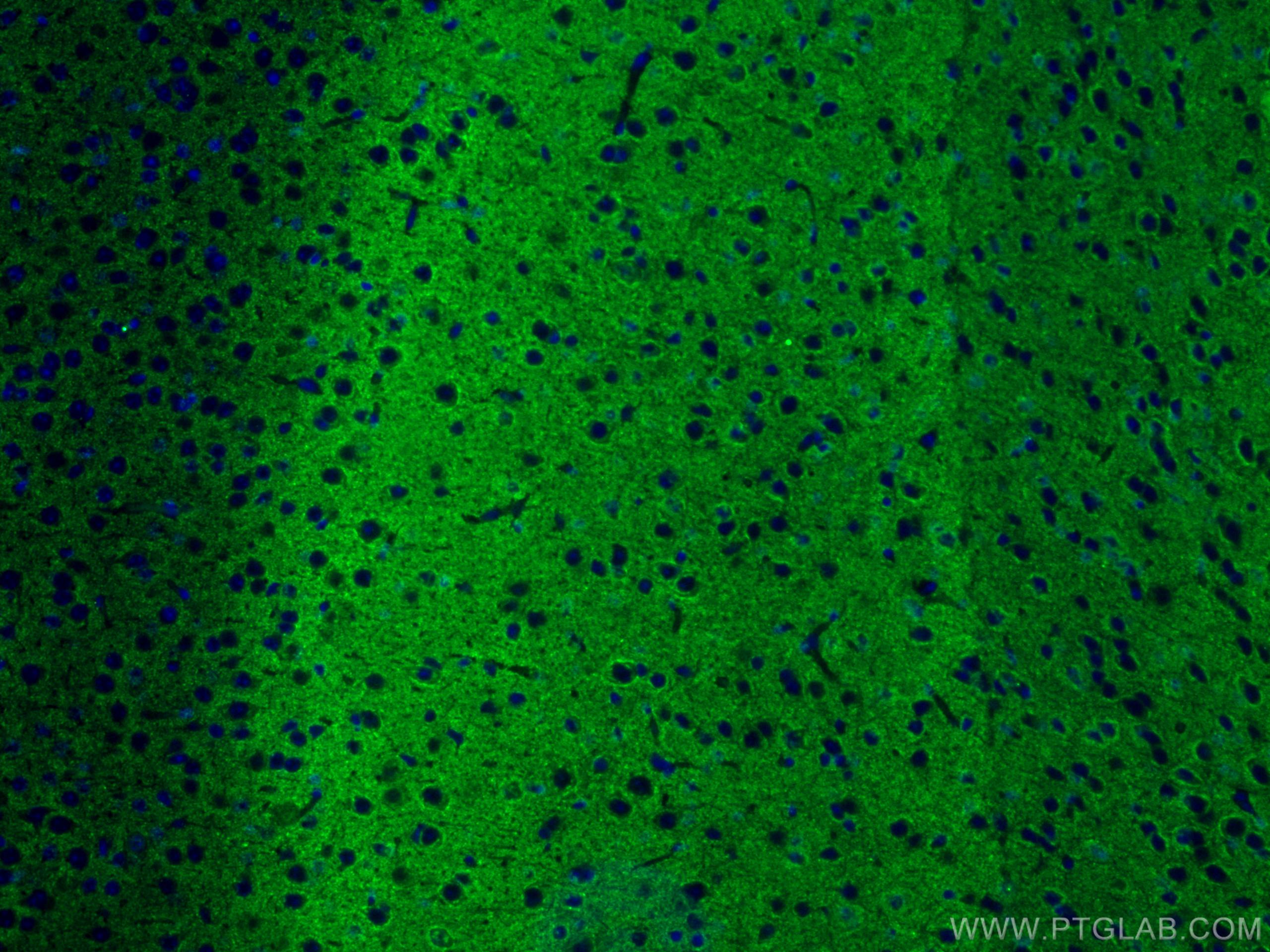 Immunofluorescence (IF) / fluorescent staining of mouse brain tissue using Synaptophysin Polyclonal antibody (17785-1-AP)