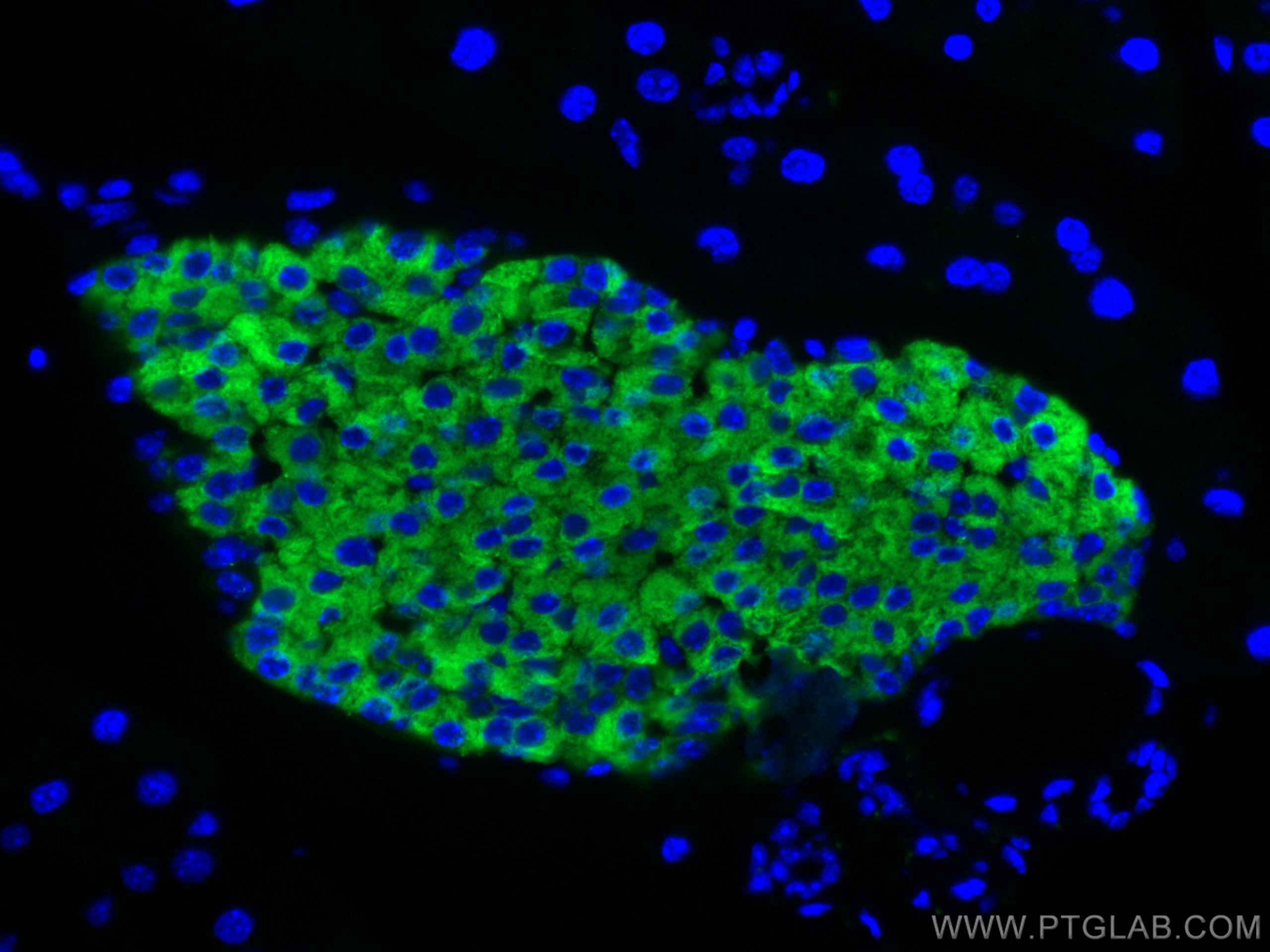 IF Staining of mouse pancreas using 17785-1-AP