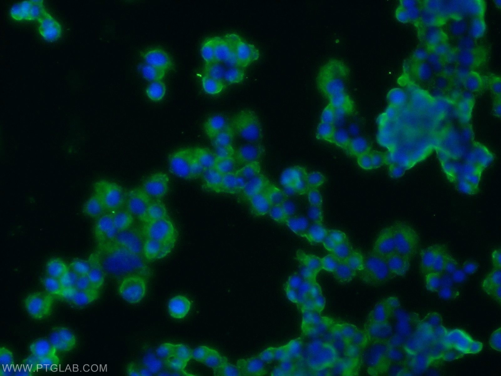 Immunofluorescence (IF) / fluorescent staining of PC-12 cells using Synaptophysin Polyclonal antibody (17785-1-AP)