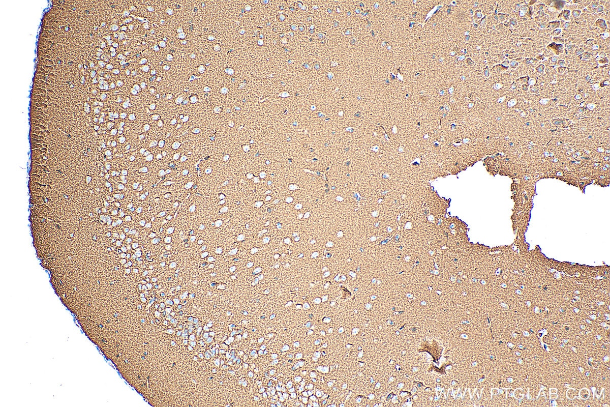 Immunohistochemistry (IHC) staining of mouse brain tissue using Synaptophysin Polyclonal antibody (17785-1-AP)