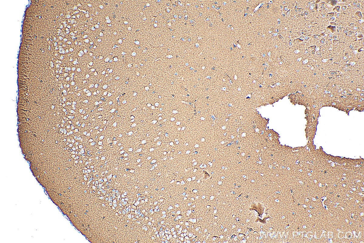 IHC staining of mouse brain using 17785-1-AP