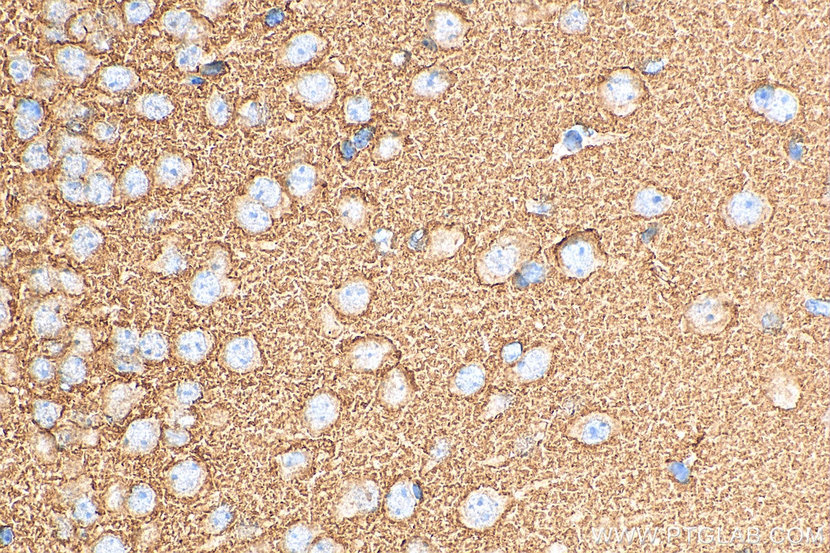 Immunohistochemistry (IHC) staining of mouse brain tissue using Synaptophysin Polyclonal antibody (17785-1-AP)