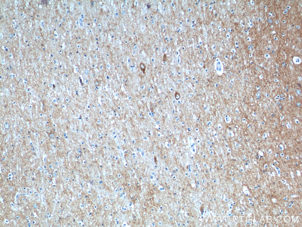 Immunohistochemistry (IHC) staining of human brain tissue using Synaptophysin Polyclonal antibody (17785-1-AP)