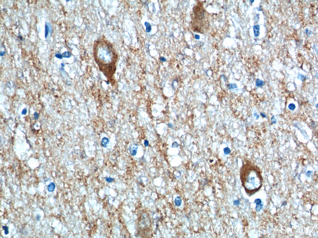Immunohistochemistry (IHC) staining of human brain tissue using Synaptophysin Polyclonal antibody (17785-1-AP)