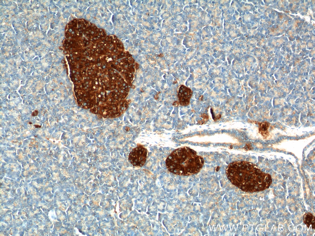 Immunohistochemistry (IHC) staining of human pancreas tissue using Synaptophysin Polyclonal antibody (17785-1-AP)
