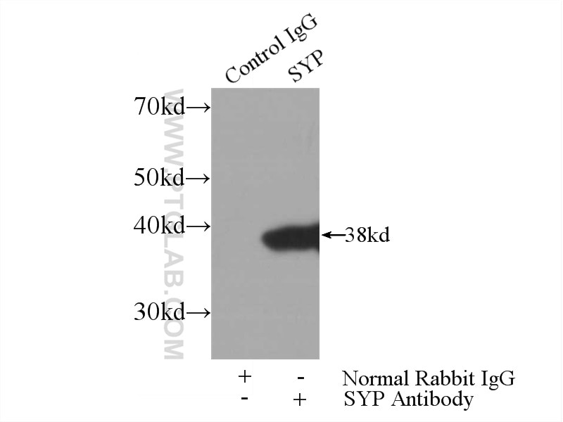 Immunoprecipitation (IP) experiment of mouse brain tissue using Synaptophysin Polyclonal antibody (17785-1-AP)