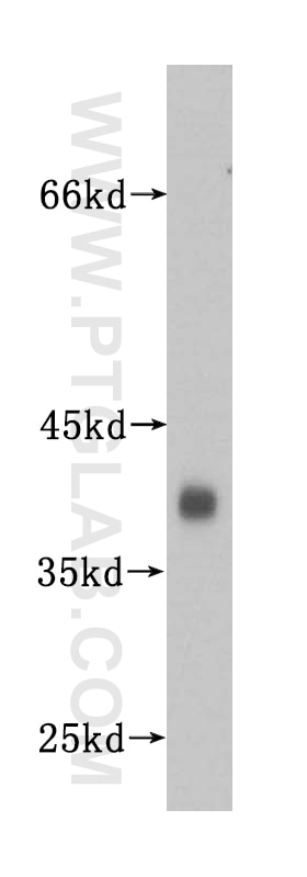 Western Blot (WB) analysis of human brain tissue using Synaptophysin Polyclonal antibody (17785-1-AP)