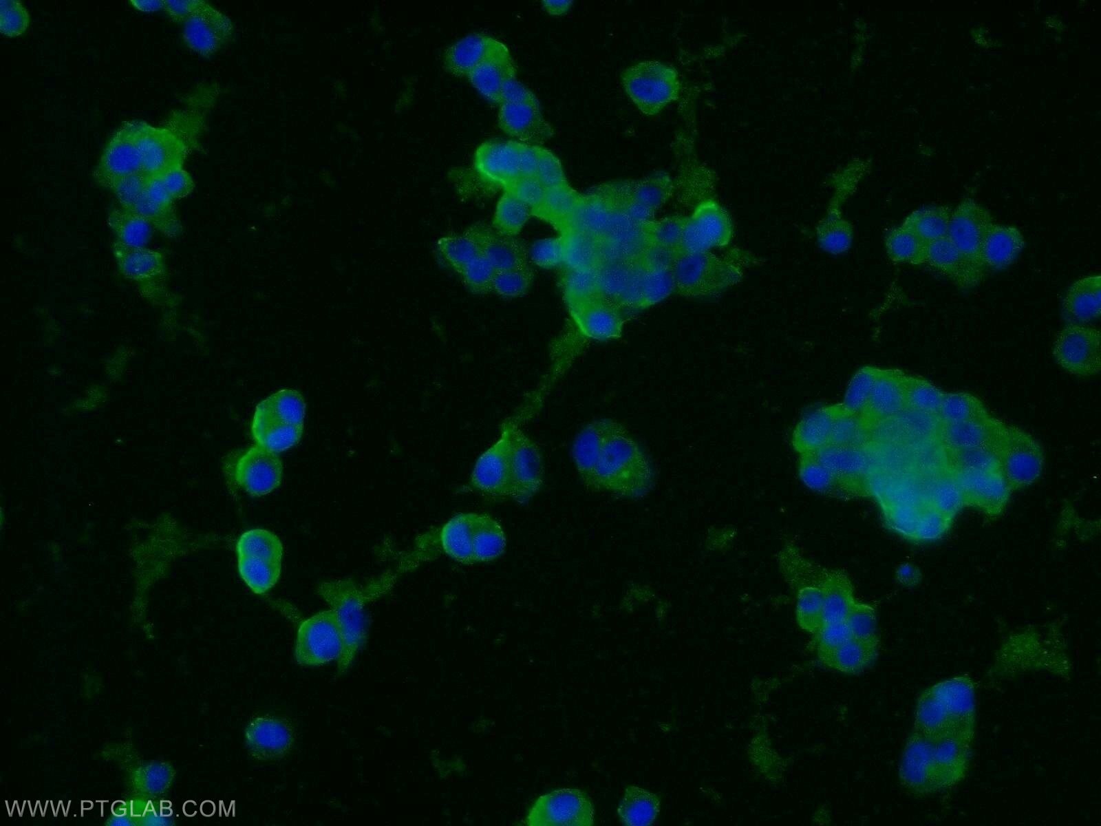 Immunofluorescence (IF) / fluorescent staining of PC-12 cells using Synaptophysin Monoclonal antibody (60191-1-Ig)