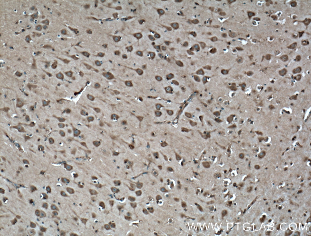 Immunohistochemistry (IHC) staining of human brain tissue using Synaptophysin Monoclonal antibody (60191-1-Ig)