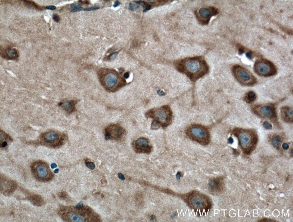 Immunohistochemistry (IHC) staining of human brain tissue using Synaptophysin Monoclonal antibody (60191-1-Ig)