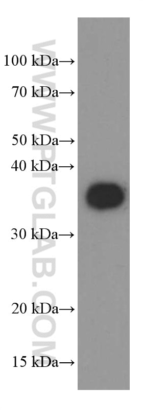 WB analysis of SH-SY5Y using 60191-1-Ig