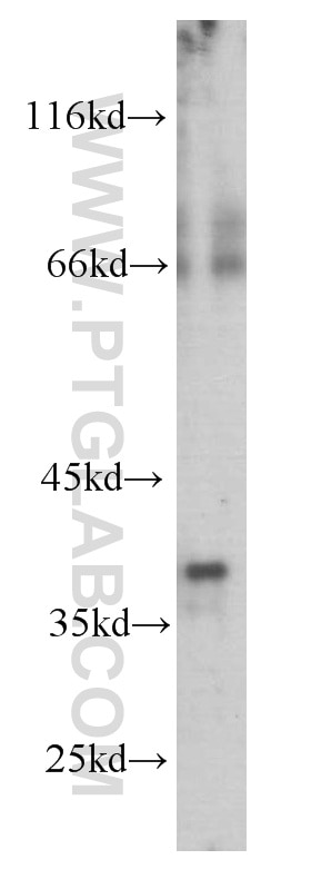 Western Blot (WB) analysis of human brain tissue using Synaptophysin Monoclonal antibody (60191-1-Ig)