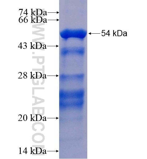 Synaptophysin; SYP fusion protein Ag11781 SDS-PAGE
