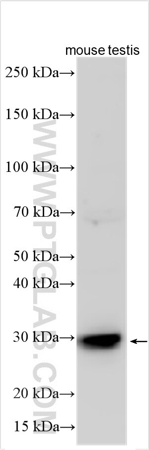 Western Blot (WB) analysis of various lysates using SYPL1 Polyclonal antibody (25145-1-AP)