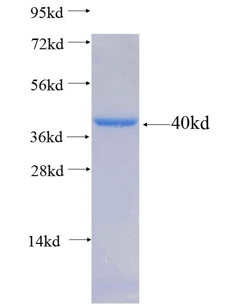 SYPL2 fusion protein Ag18103 SDS-PAGE