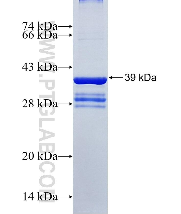 SYPL2 fusion protein Ag18103 SDS-PAGE SYPL2 fusion protein Ag18103 SDS-PAGE
