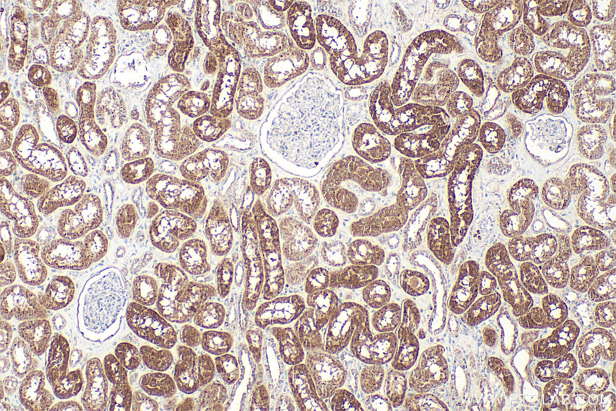 IHC staining of human kidney using 27048-1-AP (same clone as 27048-1-PBS) Immunohistochemistry (IHC) staining of human kidney tissue using SYS1 Polyclonal antibody (27048-1-AP)