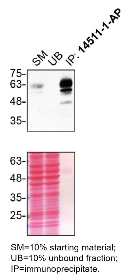 Immunoprecipitation (IP) experiment of HCT 116 cells using Synaptotagmin-1 Polyclonal antibody (14511-1-AP)
