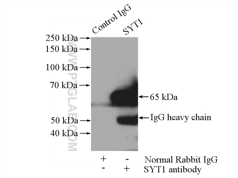 Immunoprecipitation (IP) experiment of mouse testis tissue using Synaptotagmin-1 Polyclonal antibody (14511-1-AP)