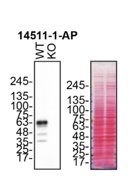 Western Blot (WB) analysis of HCT 116 cells using Synaptotagmin-1 Polyclonal antibody (14511-1-AP)