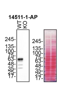 WB analysis of HCT 116 using 14511-1-AP