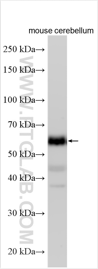 Western Blot (WB) analysis of various lysates using Synaptotagmin-1 Polyclonal antibody (14511-1-AP)
