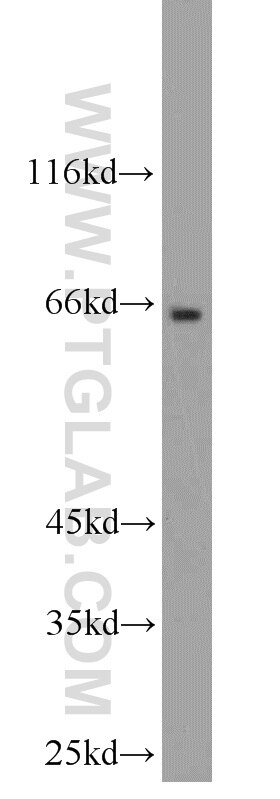 Western Blot (WB) analysis of mouse testis tissue using Synaptotagmin-1 Polyclonal antibody (14511-1-AP)
