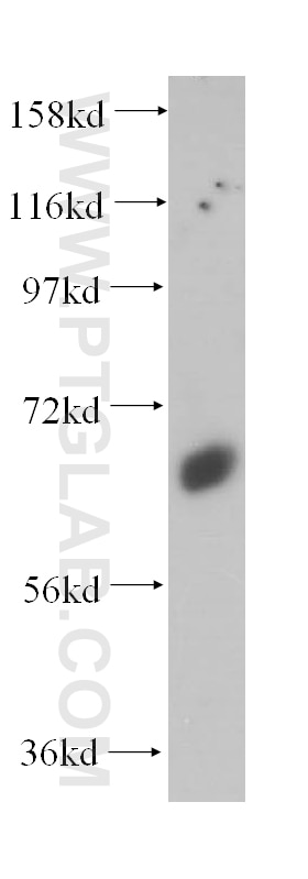 Western Blot (WB) analysis of human liver tissue using Synaptotagmin-1 Polyclonal antibody (14511-1-AP)