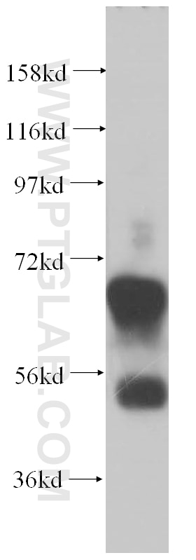 Western Blot (WB) analysis of Y79 cells using Synaptotagmin-1 Polyclonal antibody (14511-1-AP)