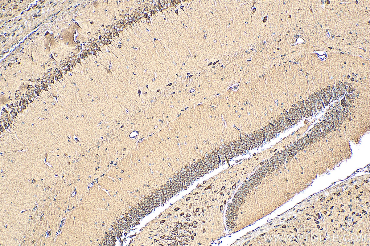 IHC staining of mouse brain using 12031-1-AP