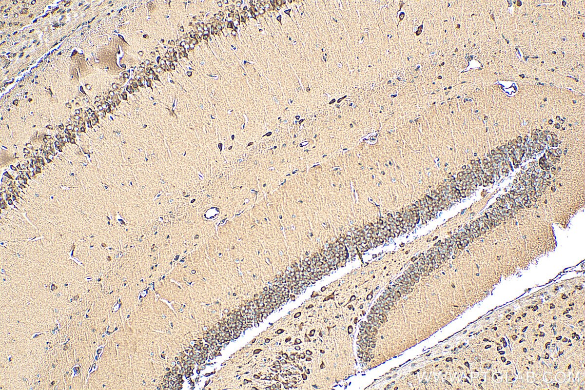 Immunohistochemistry (IHC) staining of mouse brain tissue using Synaptotagmin-11 Polyclonal antibody (12031-1-AP)