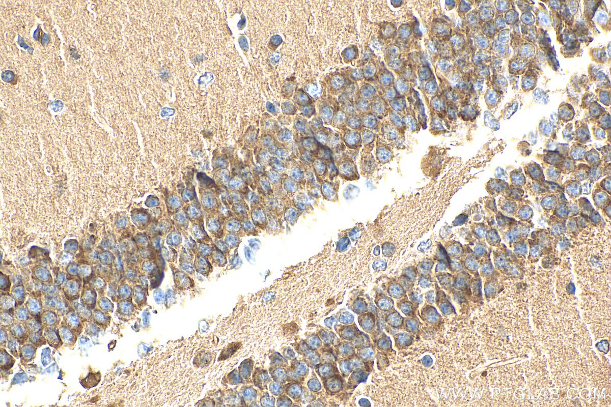 Immunohistochemistry (IHC) staining of mouse brain tissue using Synaptotagmin-11 Polyclonal antibody (12031-1-AP)