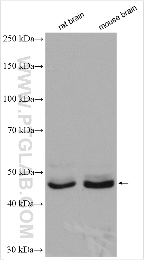 Western Blot (WB) analysis of various lysates using Synaptotagmin-11 Polyclonal antibody (12031-1-AP)