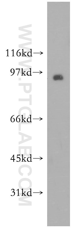 Western Blot (WB) analysis of mouse skeletal muscle tissue using Synaptotagmin-11 Polyclonal antibody (12031-1-AP)