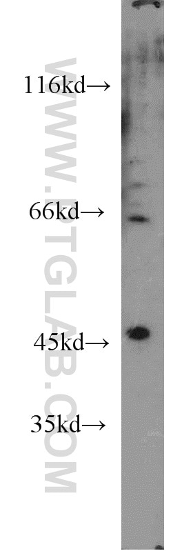 Western Blot (WB) analysis of HepG2 cells using Synaptotagmin-13 Polyclonal antibody (18115-1-AP)