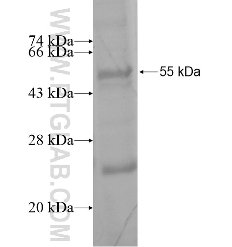 SYT15 fusion protein Ag15468 SDS-PAGE