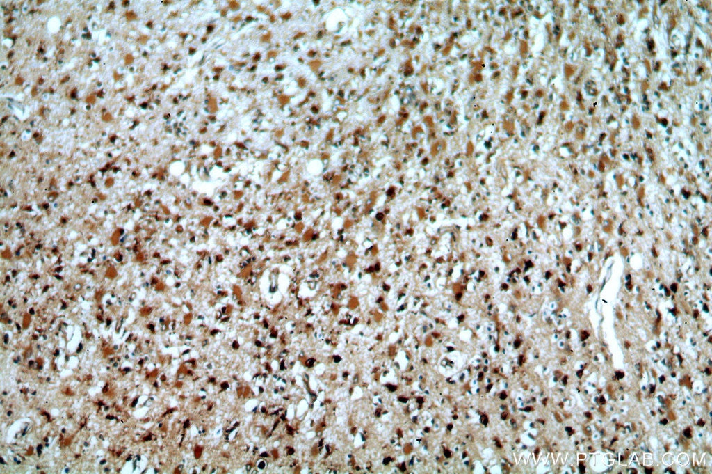 Immunohistochemistry (IHC) staining of human brain tissue using SYT17 Polyclonal antibody (15413-1-AP)